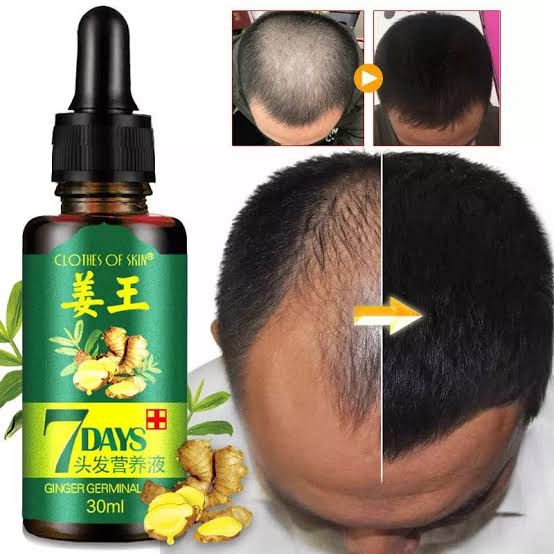 Hair Regrow 7 Day, Ginger Germinal Essential Oil Hair Growth Hair Loss Treatment Hair Care Hair Growth Serum for Men & Women 30ml