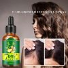 Hair Regrow 7 Day, Ginger Germinal Essential Oil Hair Growth Hair Loss Treatment Hair Care Hair Growth Serum for Men & Women 30ml