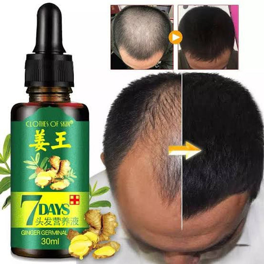 Hair Regrow 7 Day, Ginger Germinal Essential Oil Hair Growth Hair Loss Treatment Hair Care Hair Growth Serum for Men & Women 30ml