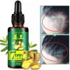 Hair Regrow 7 Day, Ginger Germinal Essential Oil Hair Growth Hair Loss Treatment Hair Care Hair Growth Serum for Men & Women 30ml